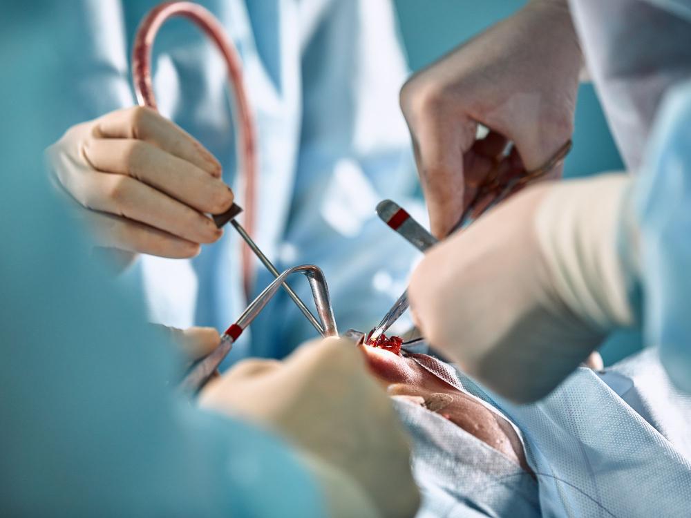 Close-up image of a facial surgery
