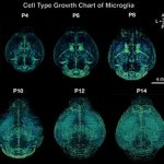 A series of scans showing 3D brain images