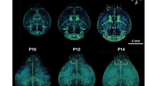 New detailed brain growth atlas in mice offers insights into brain development