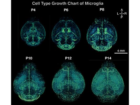 A series of scans showing 3D brain images