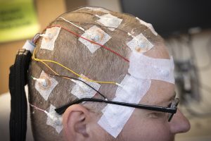 A close-up of a man’s head is seen from the side with wires and leads taped to his head for an electroencephalogram. He is wearing glasses.
