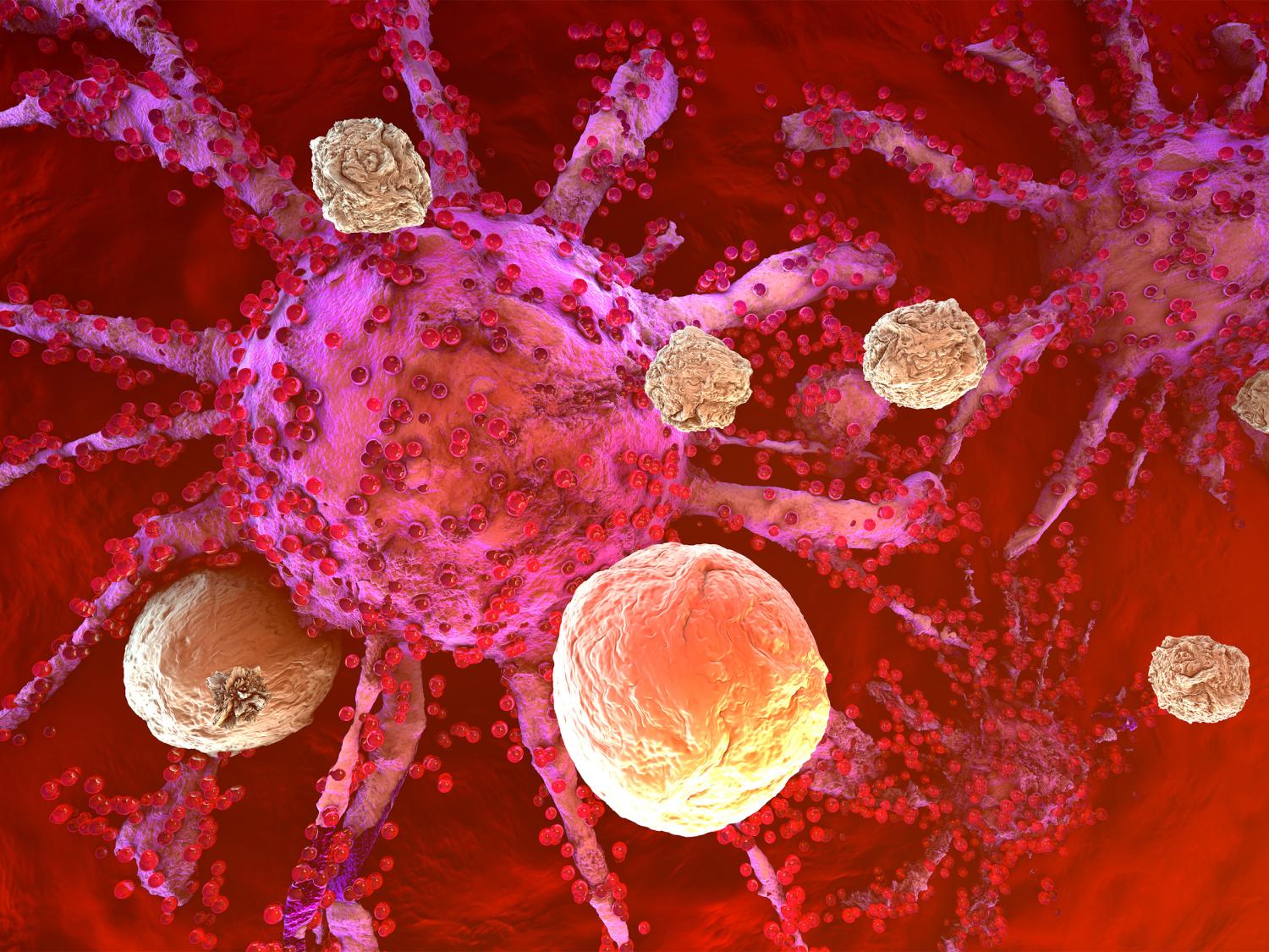 A 3D model of cancer cells being attacked by the immune system cells found in the body.