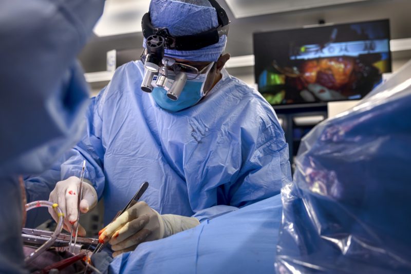 A surgeon wearing a blue surgical gown, mask, and magnifying loupes performs a heart transplant surgery in an operating room, using instruments while monitors display the procedure in the background.