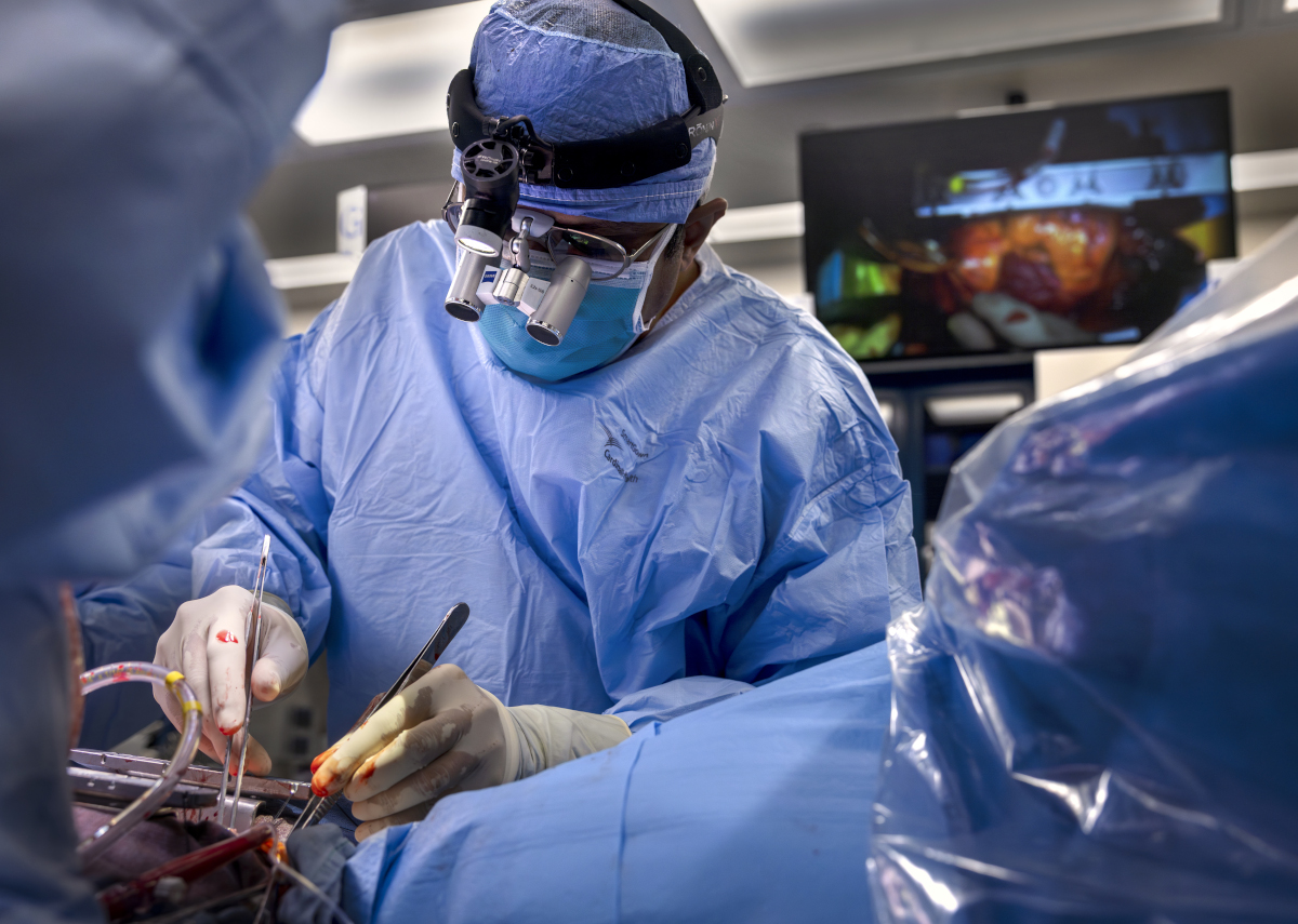 A surgeon wearing a blue surgical gown, mask, and magnifying loupes performs a heart transplant surgery in an operating room, using instruments while monitors display the procedure in the background.