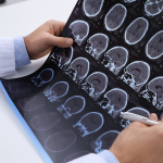 Black and white images from brain CT scan