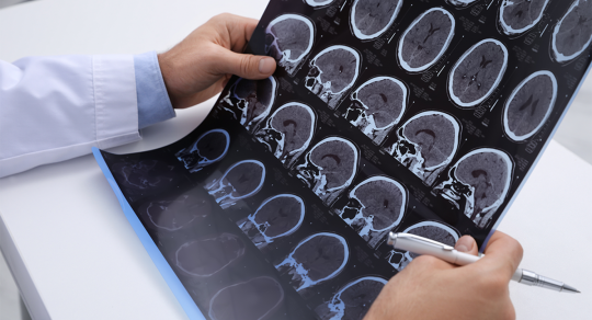 How AI integrated into clinical workflow lowers medical liability perception