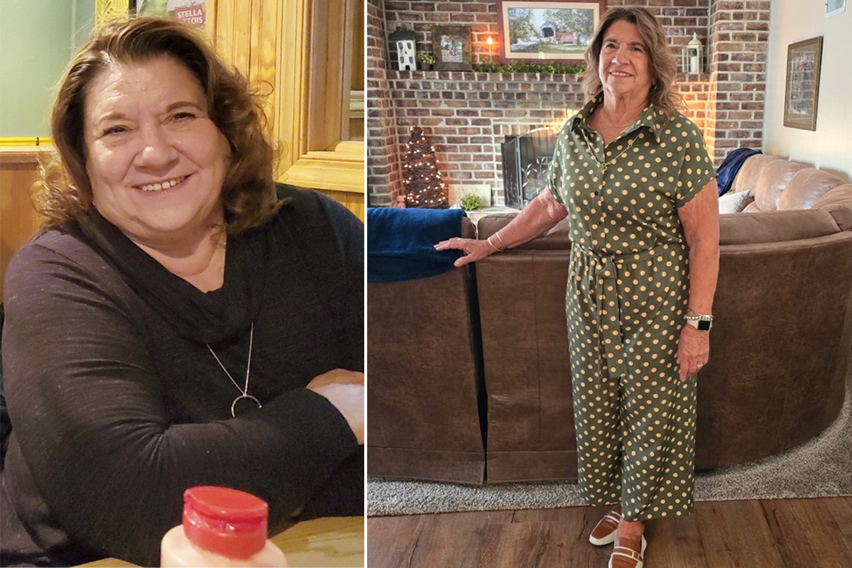 Before-and-after photos of Deborah Dunn following her weight loss.